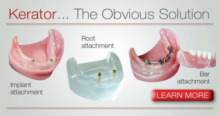 overdenture